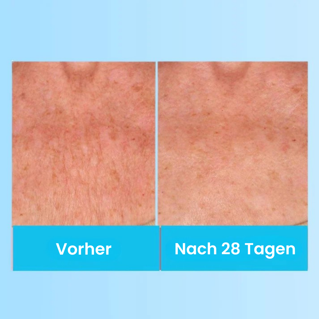 LumiLift - Straffende Schönheitscreme