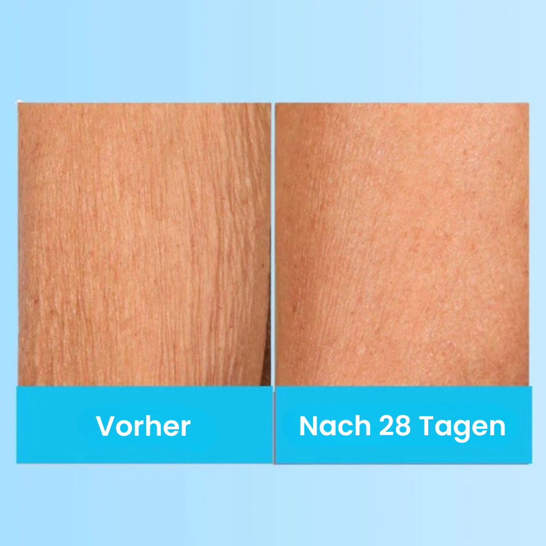 LumiLift - Straffende Schönheitscreme