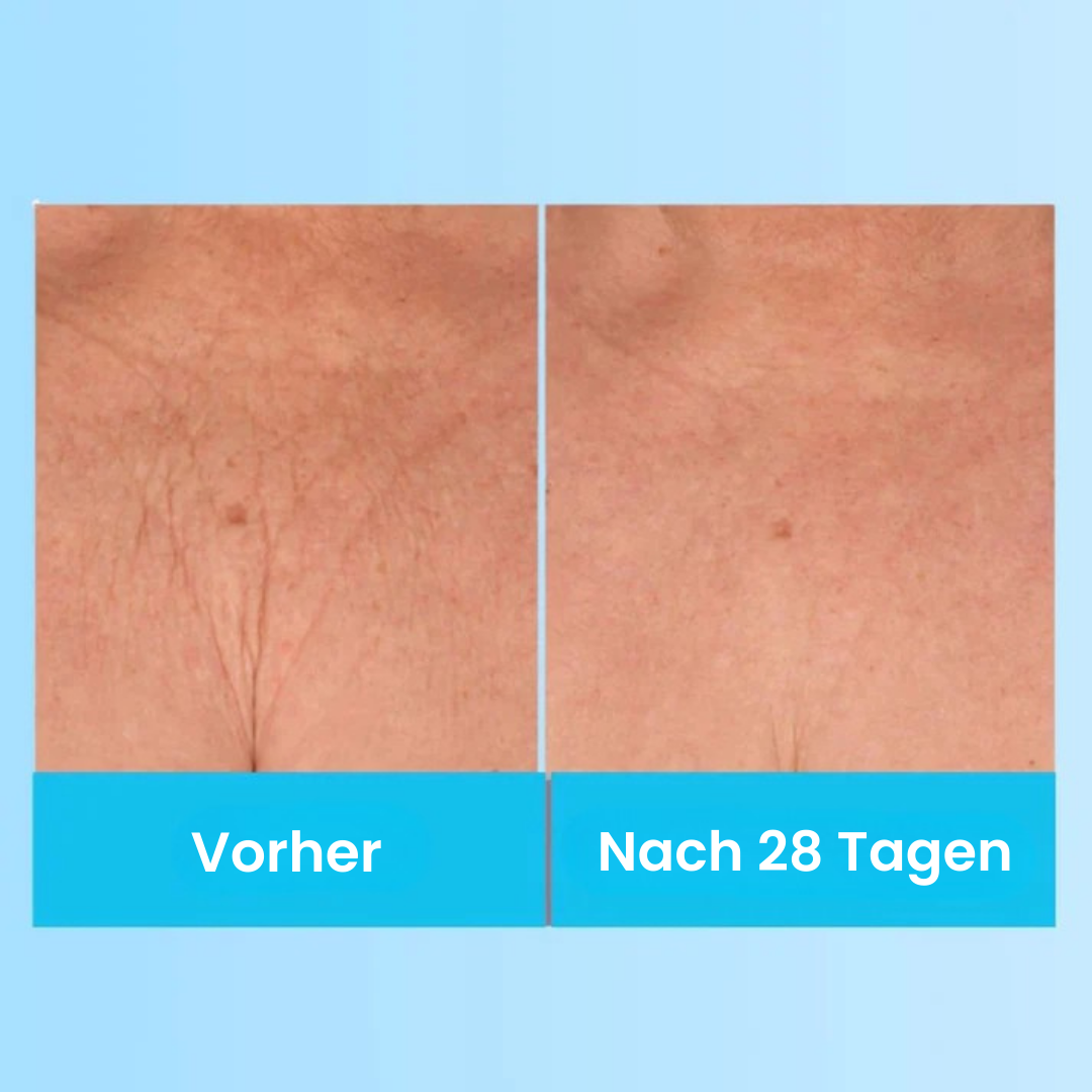 LumiLift - Straffende Schönheitscreme