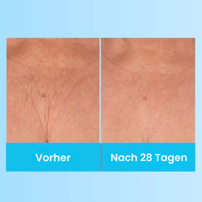 LumiLift - Straffende Schönheitscreme