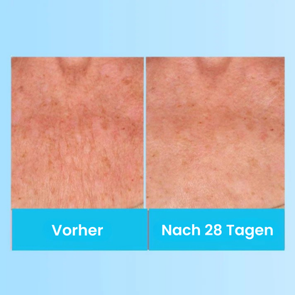 LumiLift - Straffende Schönheitscreme